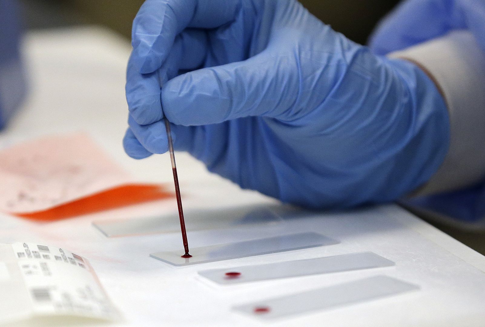 Blood Group Test Reagent 3