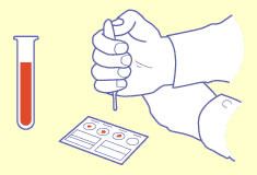 Blood Group Test Reagent 4