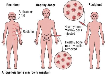 Bone Marrow 6
