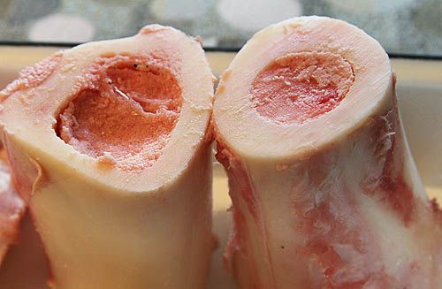 Bone Marrow 7