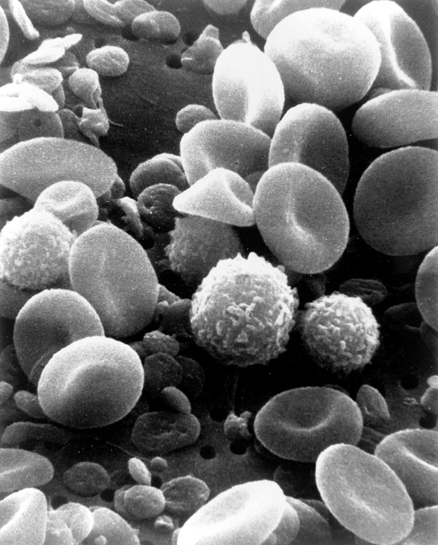 WBC Cell 19