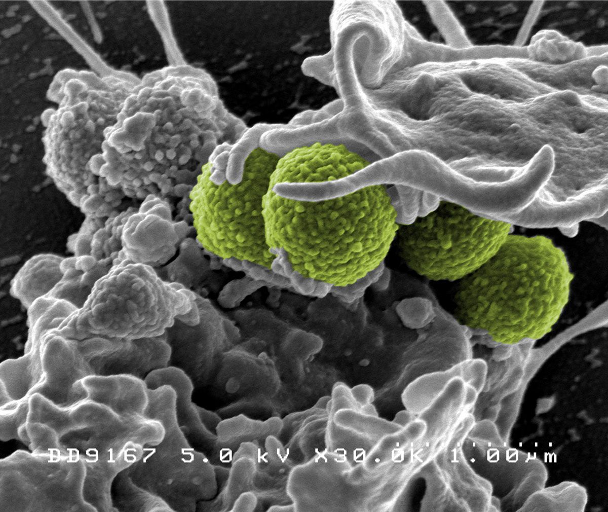 WBC Cell 22