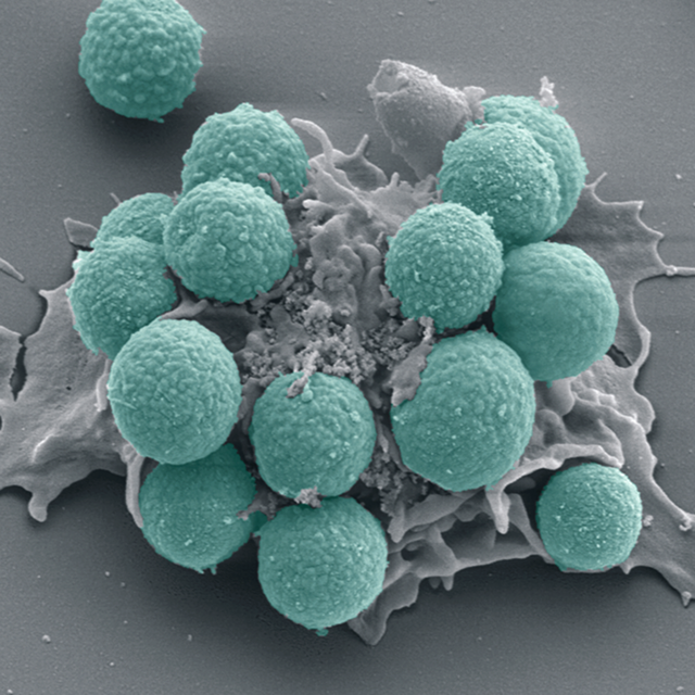 WBC Cell 23